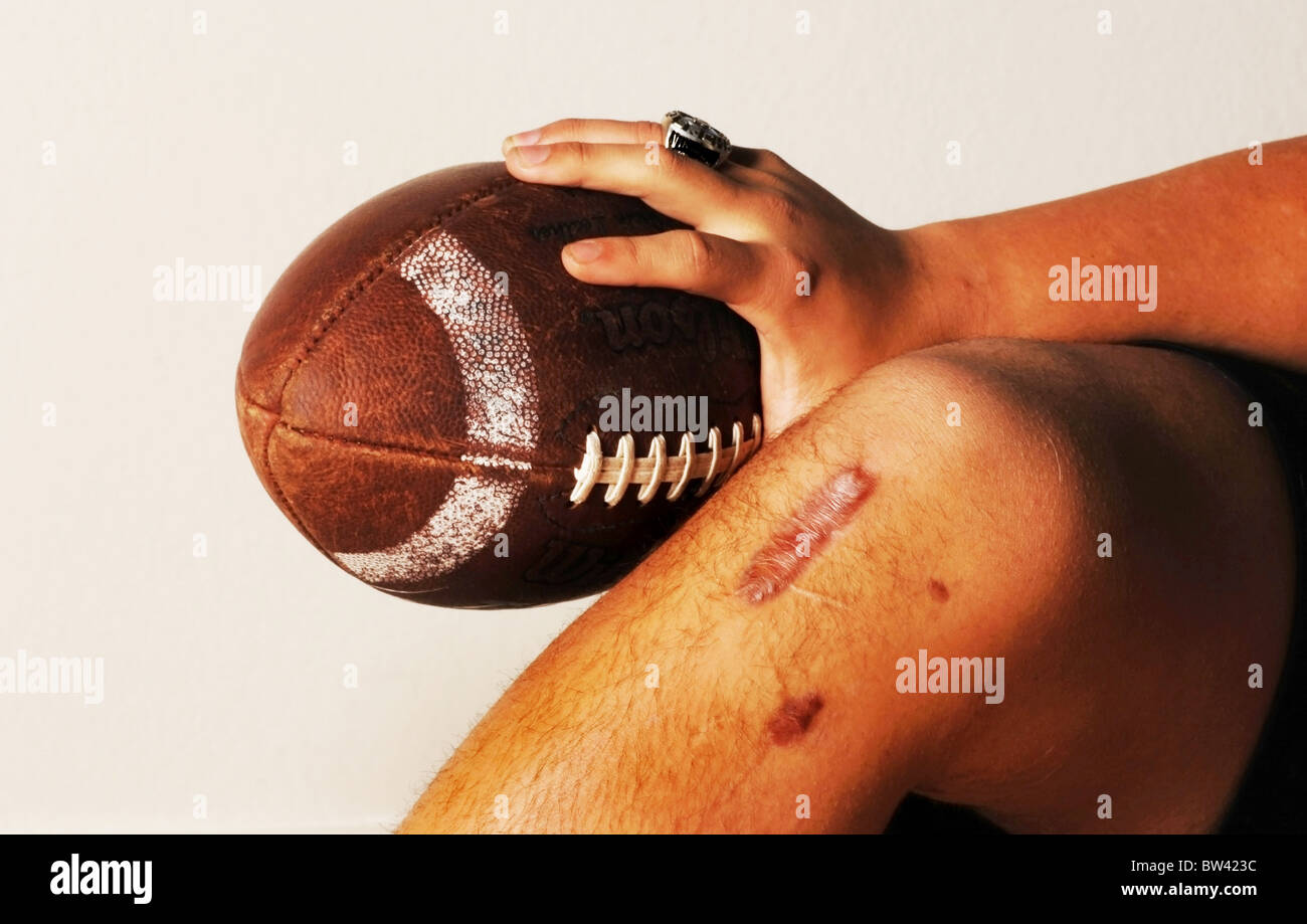 ACL football injury. Stock Photo