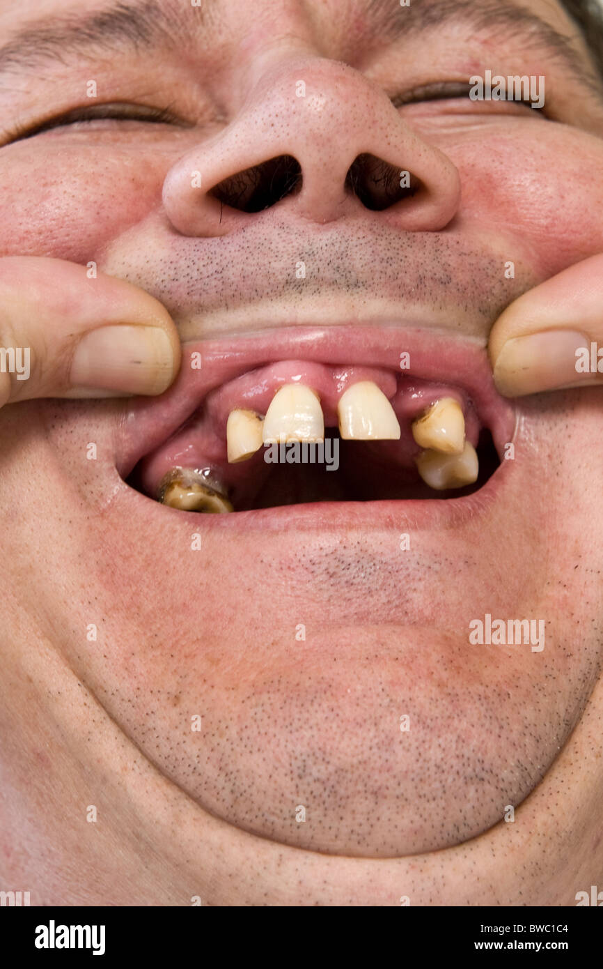 mouth Stock Photo