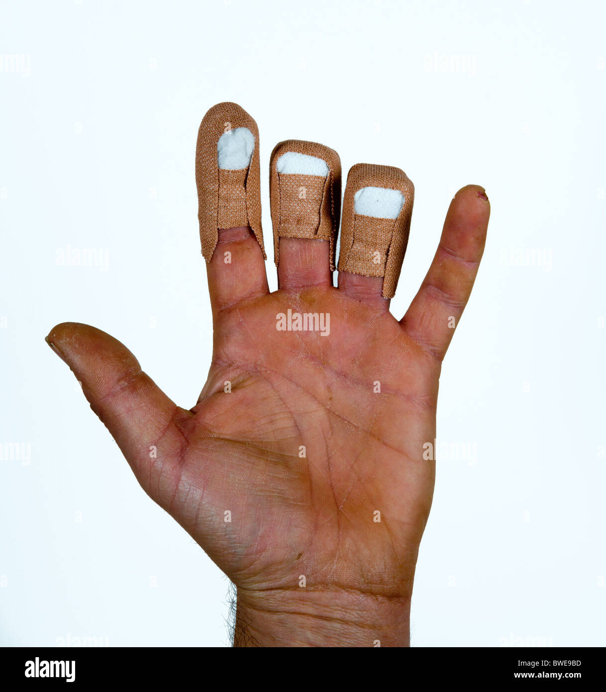 Missing Fingers Stock Photos & Missing Fingers Stock Images - Alamy