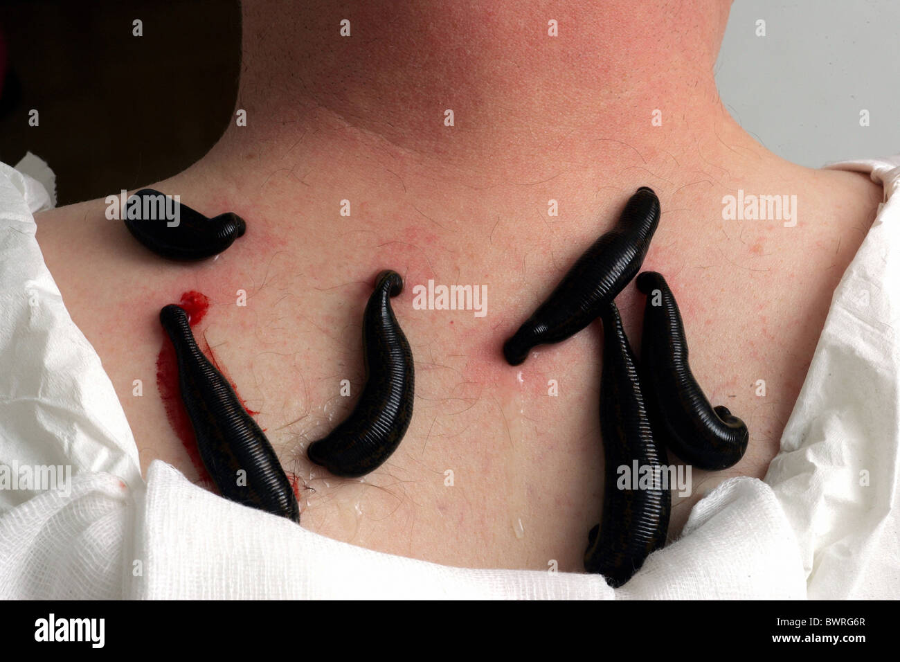 Medical leeches hi-res stock photography and images - Alamy