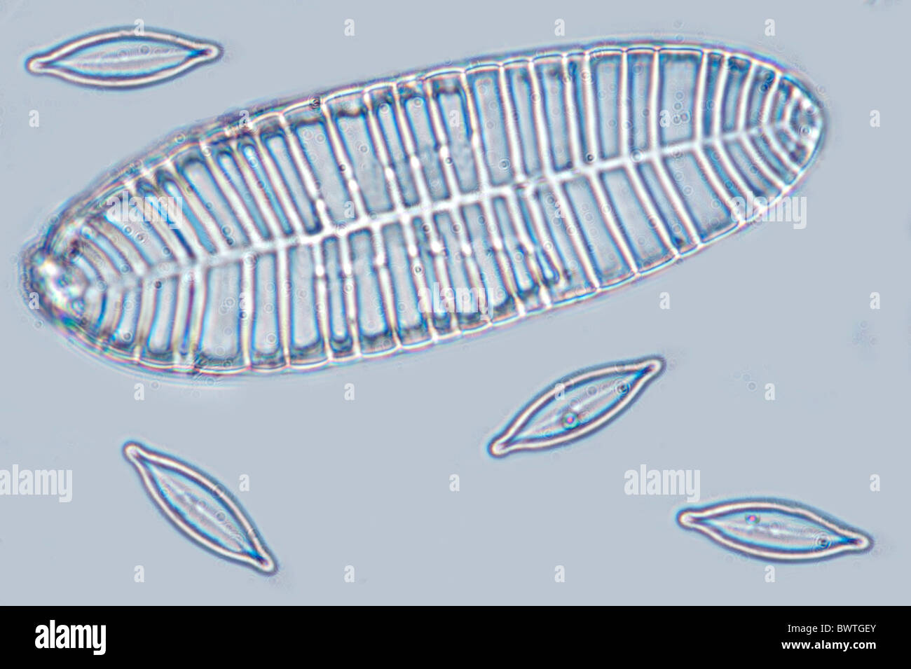 Diatom Suriralla gemma microscopic Stock Photo