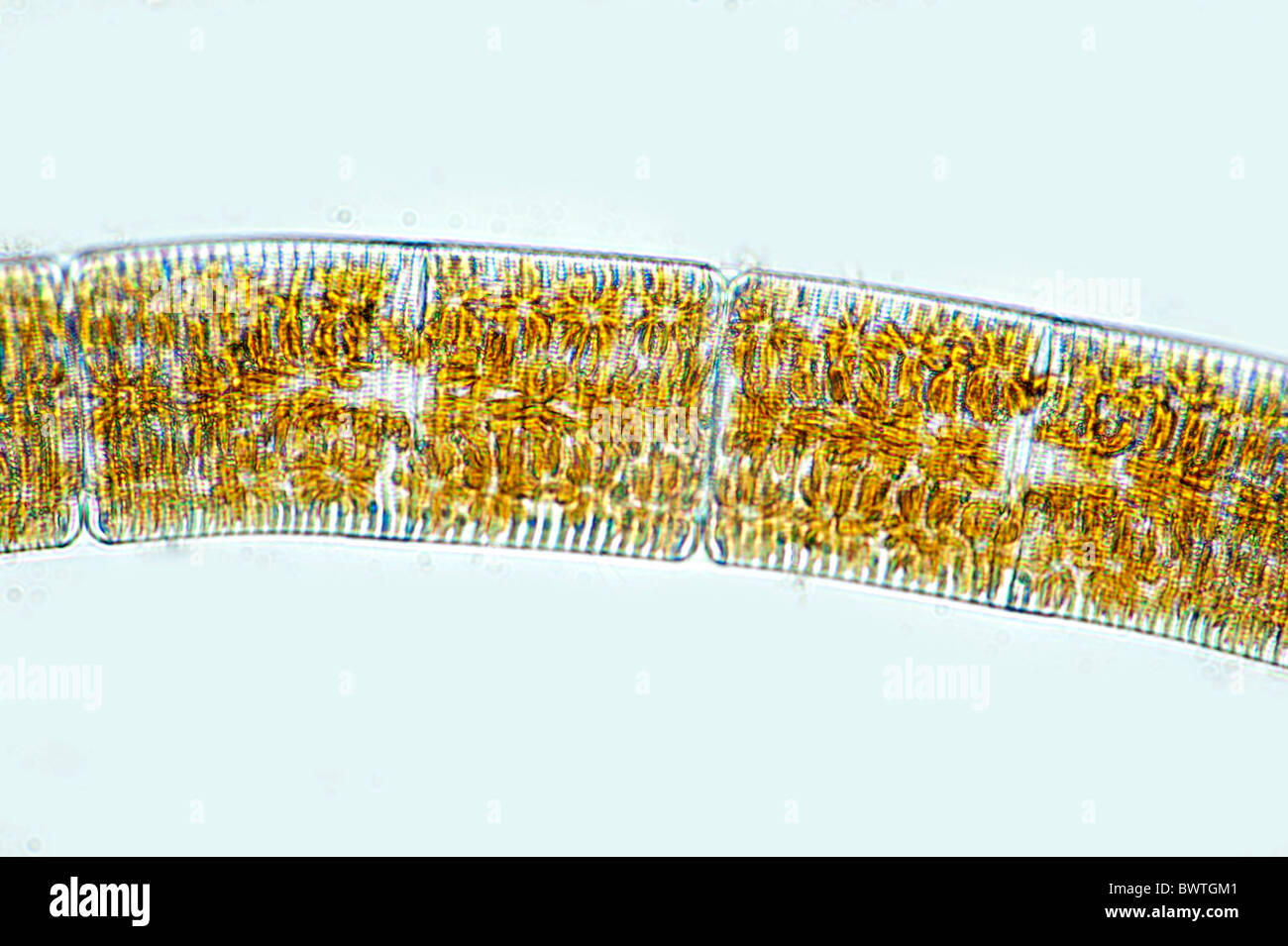 Phytoplankton Epighytic Marine Diatom Stock Photo