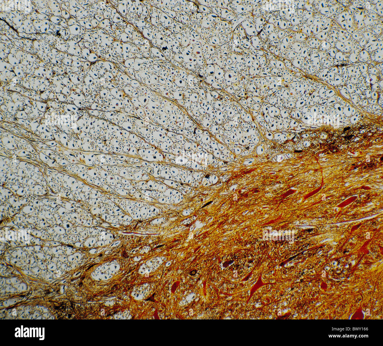 medicine microscope microscopy 40 1 spinal cord nerve cells colored medulla spinalis Stock Photo