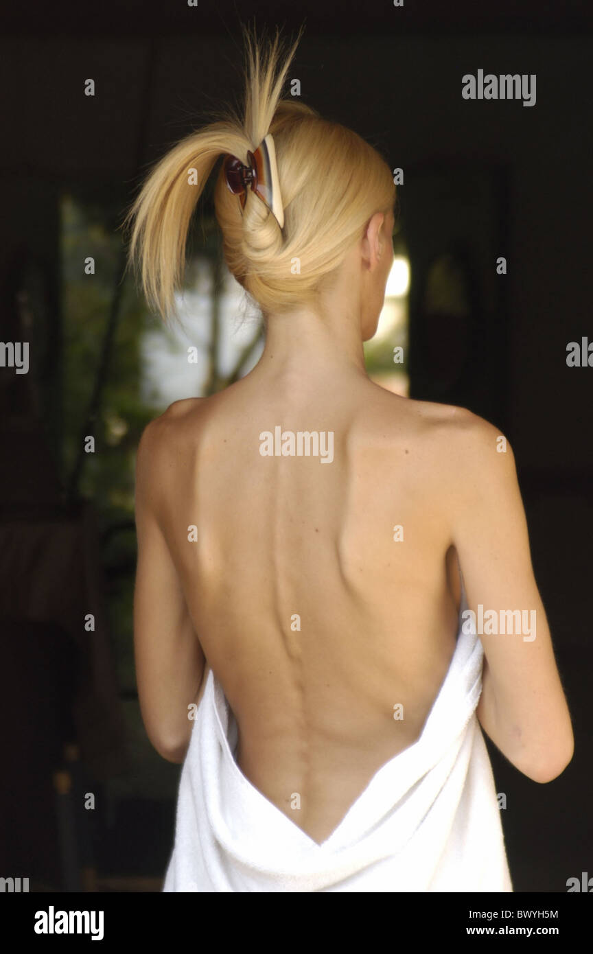 anorexic 