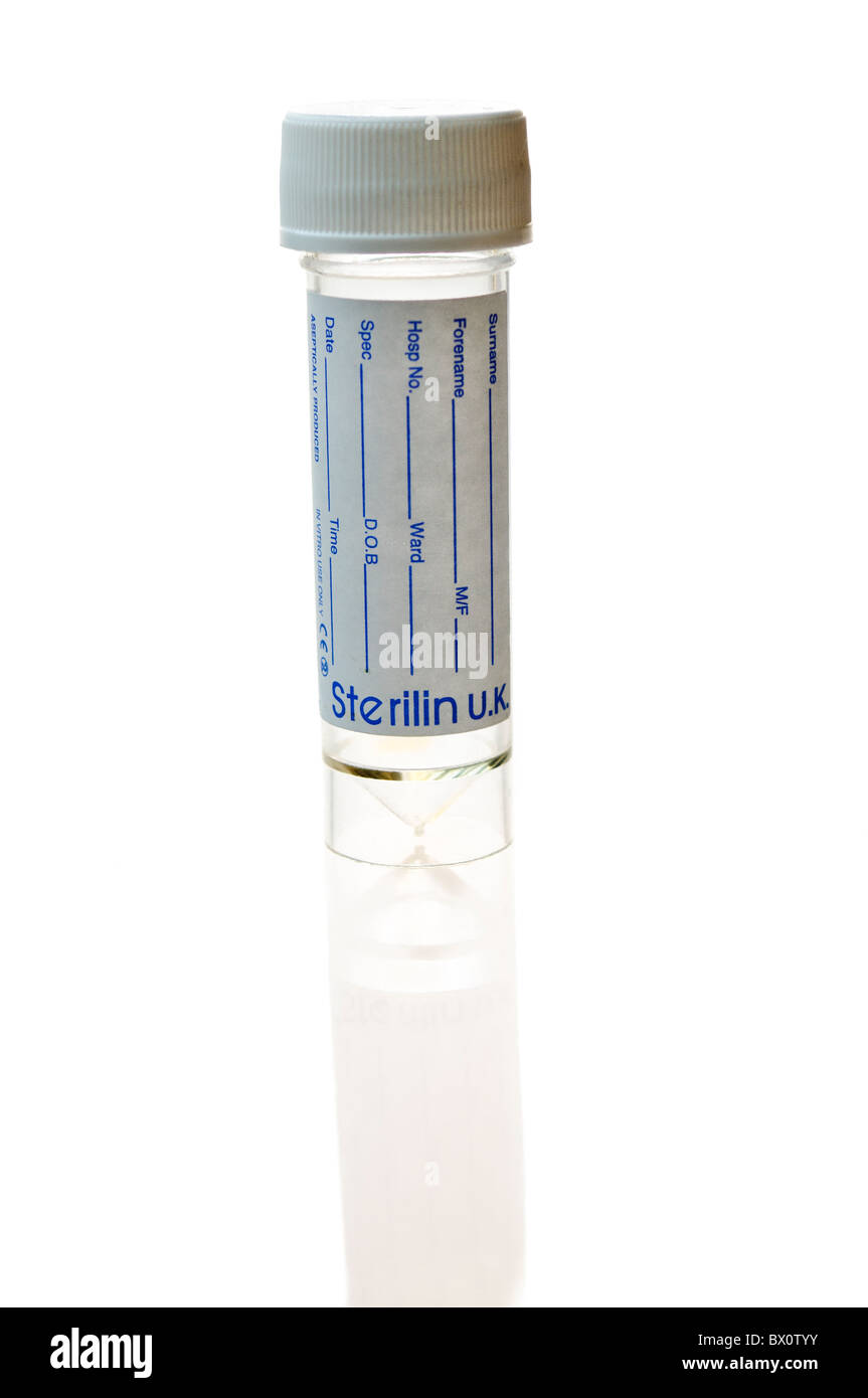 Empty urine specimen bottle Stock Photo Alamy