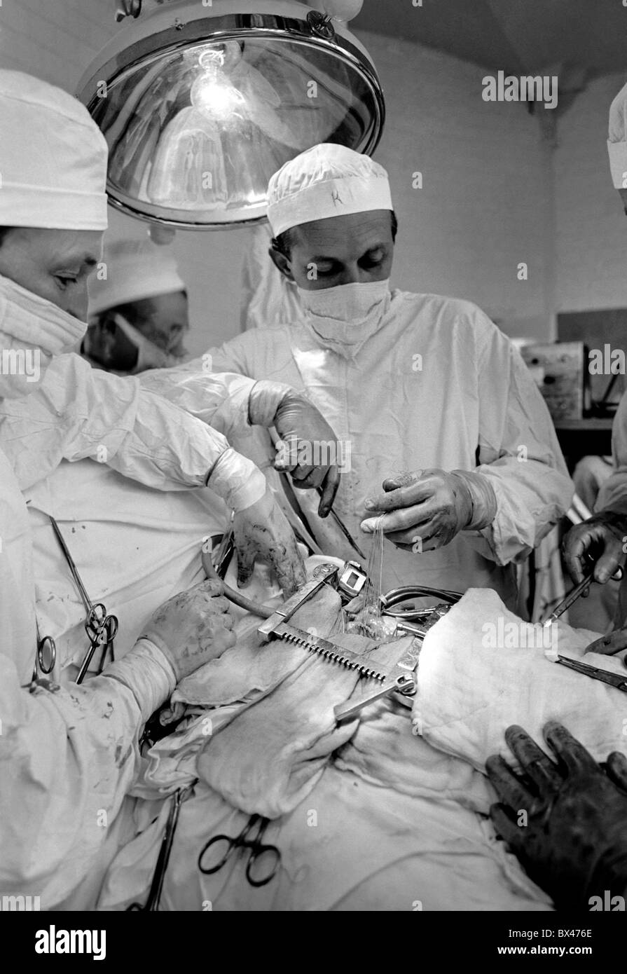 Heart surgery at II. surgical clinic in Brno, October 1961. CTK Photo