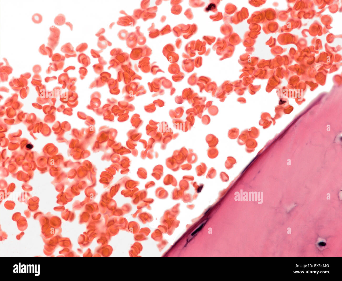 Blood, light micrograph Stock Photo