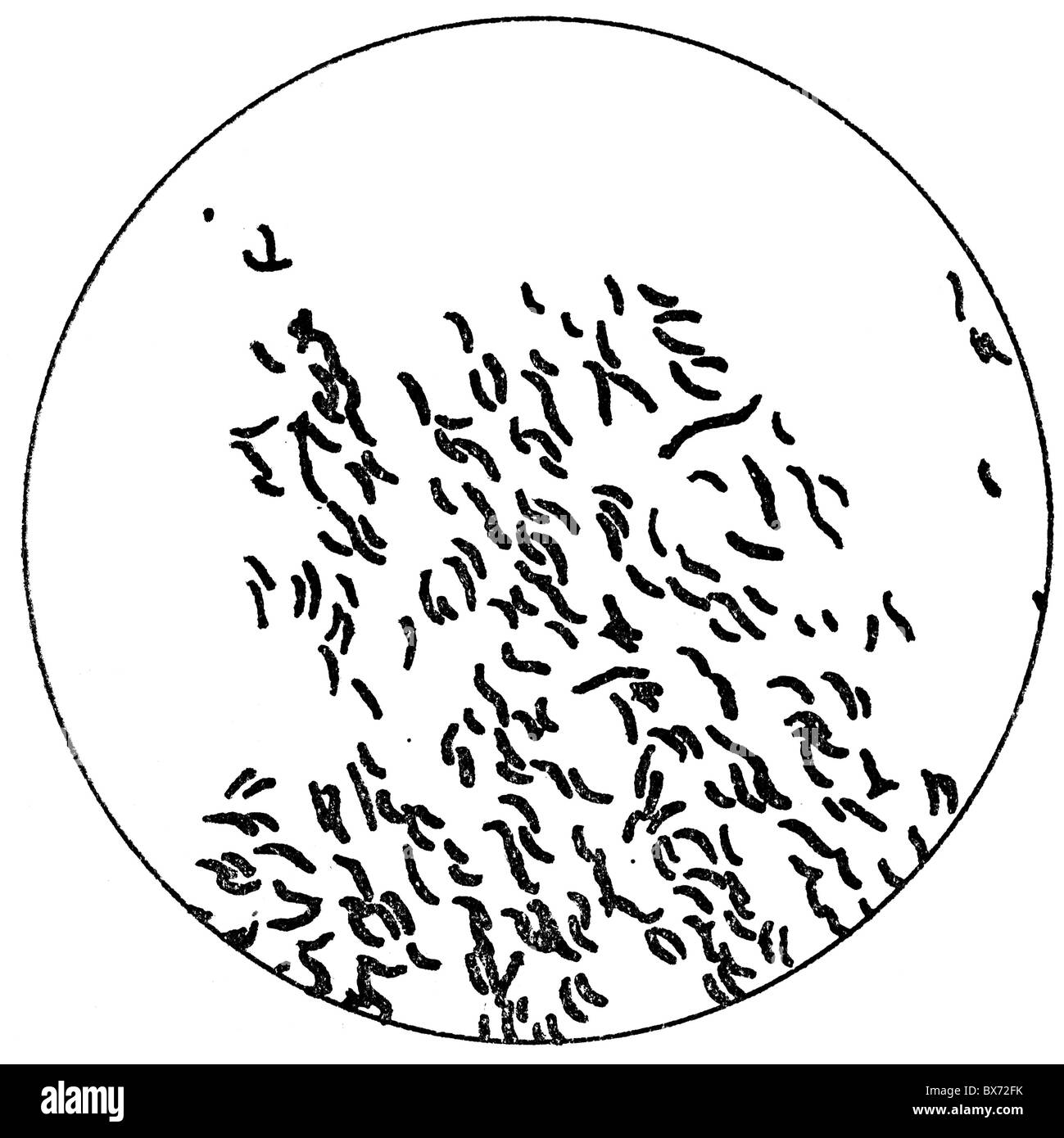 vibrio cholera sketchy micro flashcard vibrio cholera sketchy micro flashcard