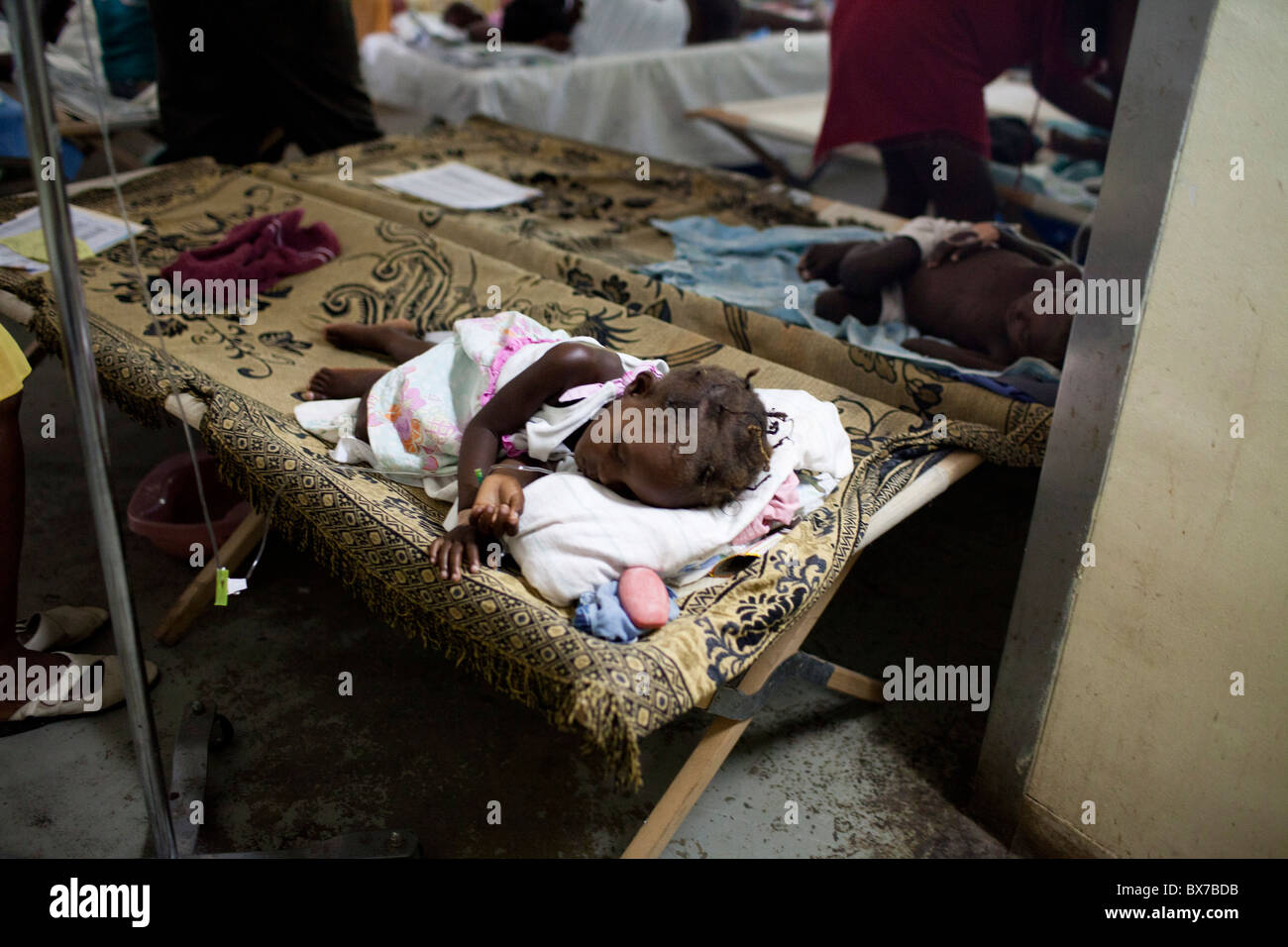 Patient of cholera hi-res stock photography and images - Alamy