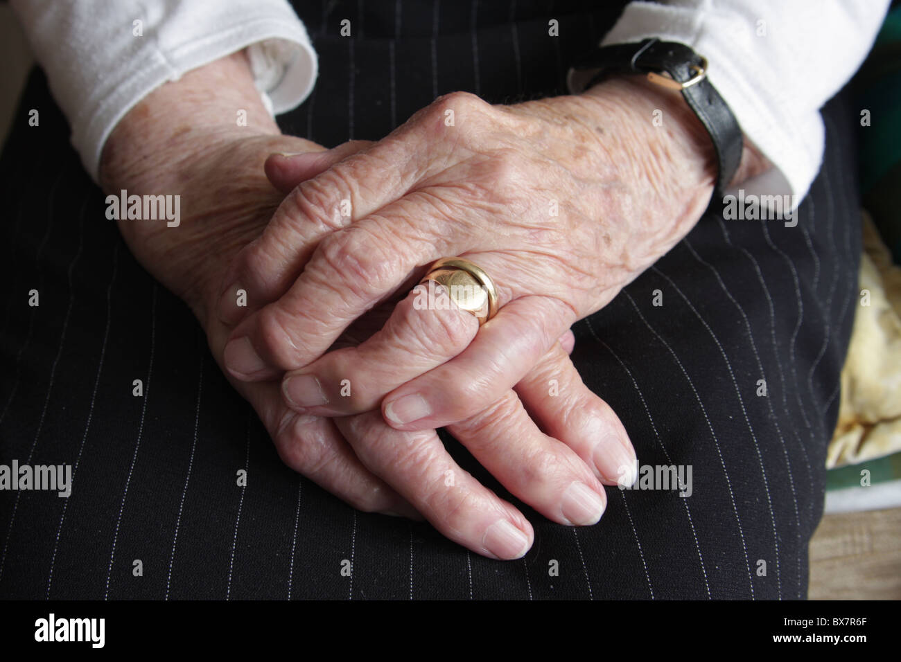 Rheumatoid arthritis hands hires stock photography and images Alamy