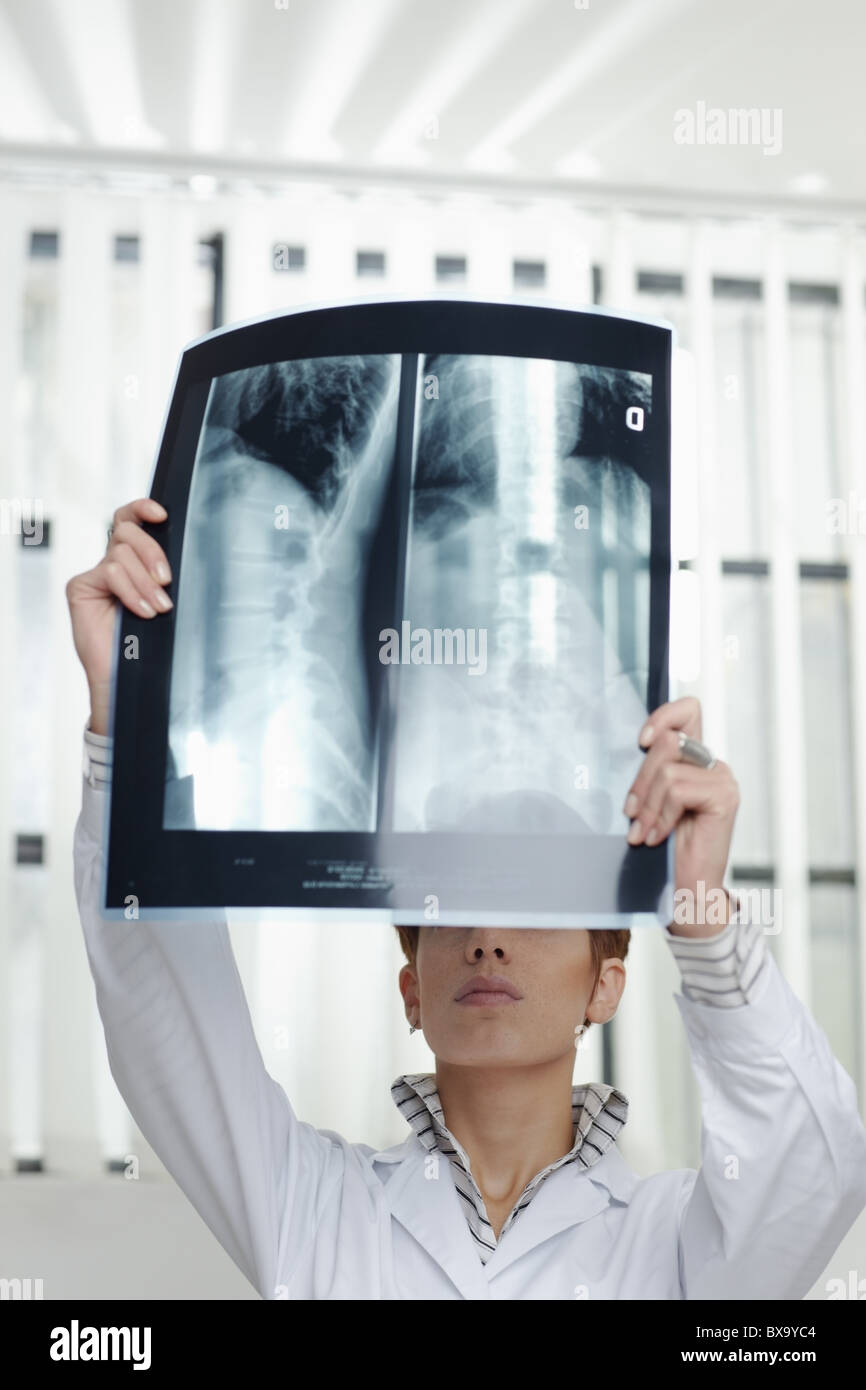 cropped view of caucasian woman looking at x-ray picture of backbone. Vertical shape, front view Stock Photo