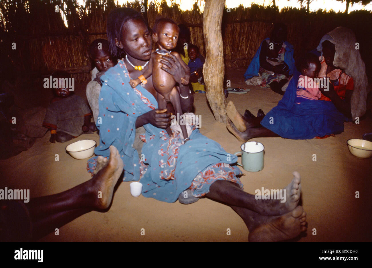 Sudan Green Camp Starving Children Marasmus Stock Photo