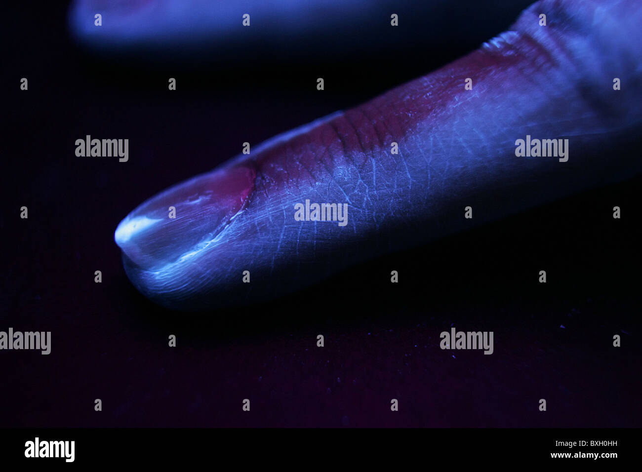 Hands placed under a UV light source indicate how effective normal hand-washing has been. Dark areas indicate missed areas. Stock Photo