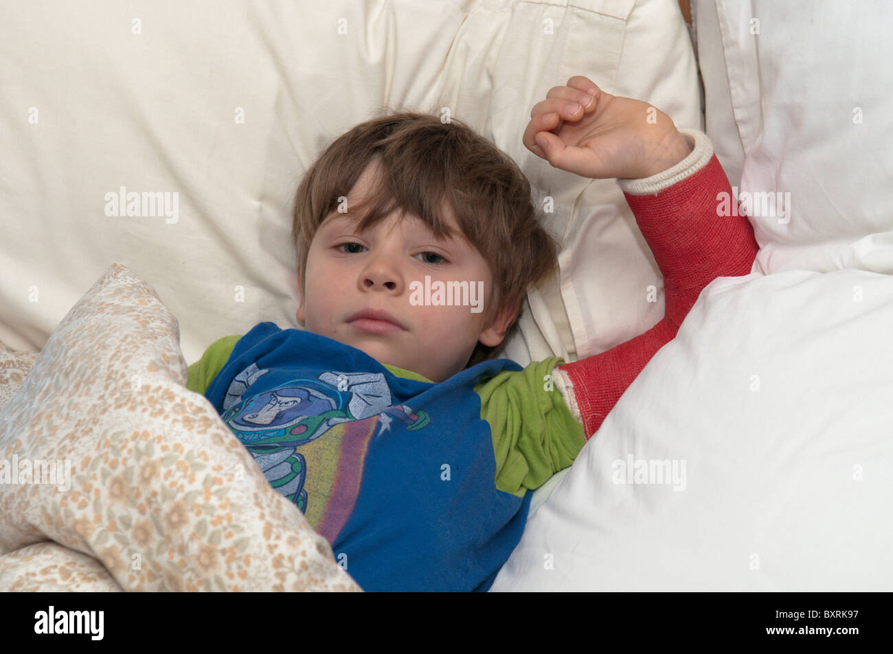Four-year-old boy with broken arm laying in bed. Red plaster cast. Stock Photo