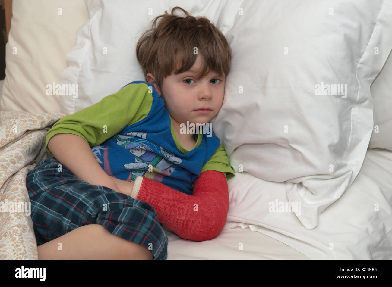 Fouryearold boy with broken arm laying in bed. Red plaster cast Stock