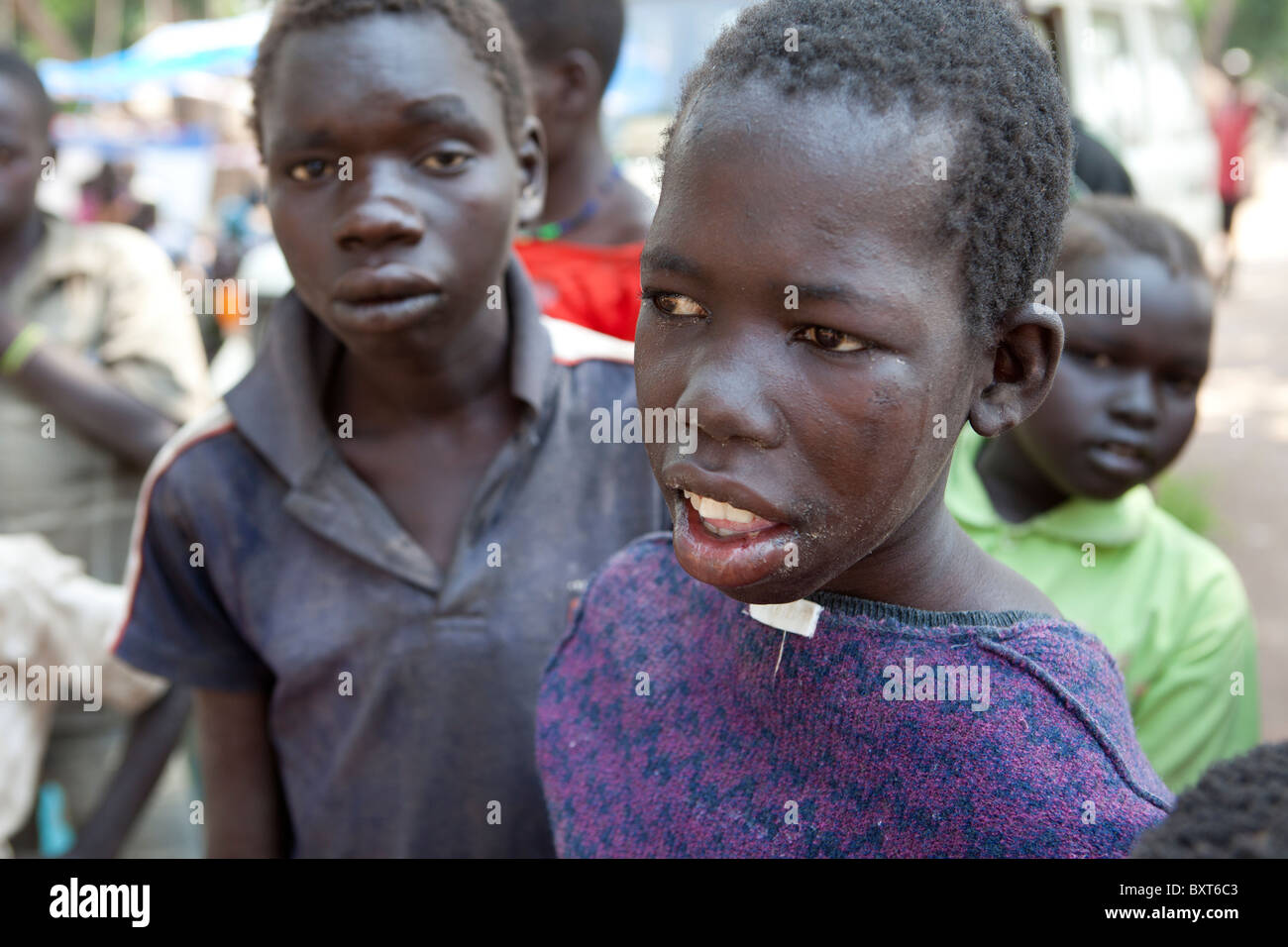 Nodding Disease,  an incurable degenerative brain disease, attacks children and teens - 30 children in Jambo IDP camp have it. Stock Photo