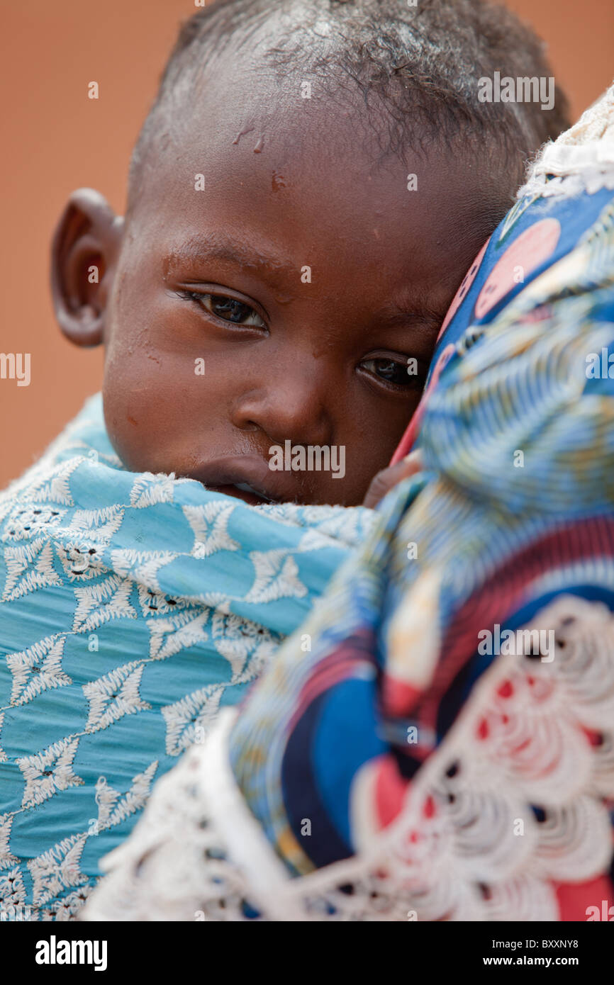 In the town of Djibo in northern Burkina Faso, a Fulani child is sick with malaria. Stock Photo