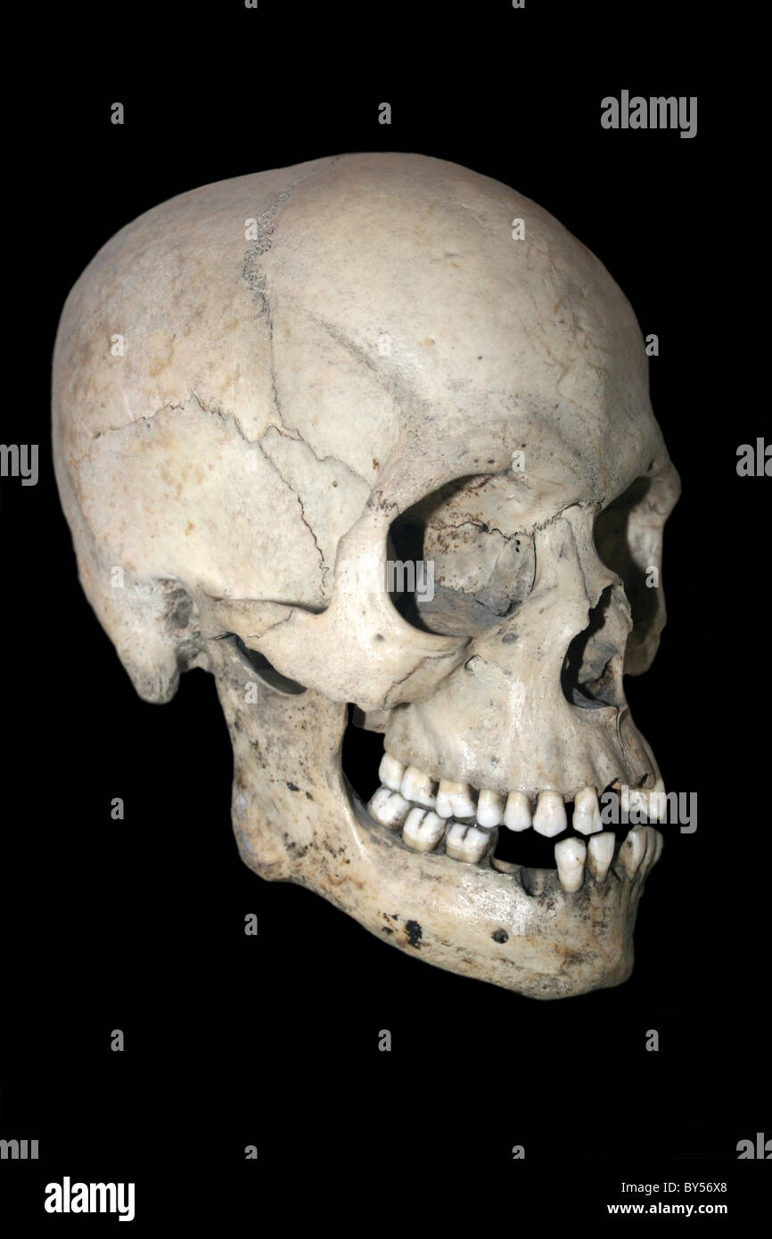 Side View Of A Human Skull Stock Photo