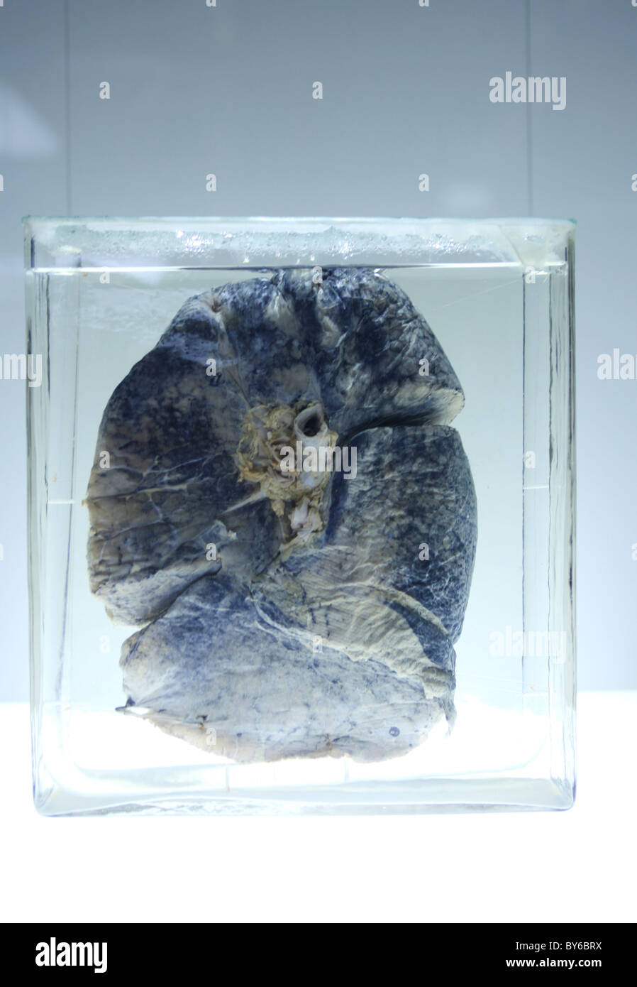 Damaged and polluted lung on display Stock Photo