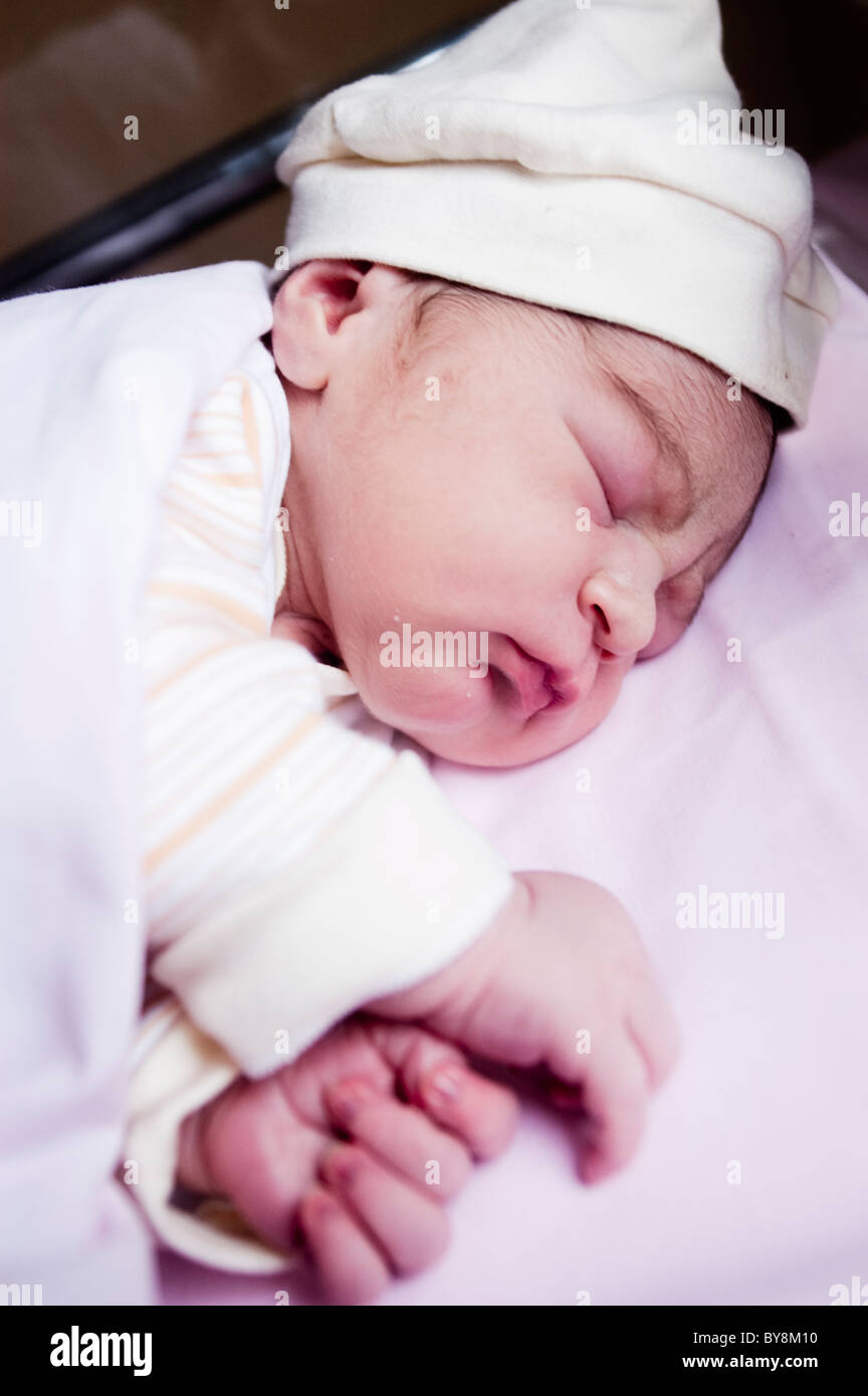 Bebé con costra láctea Fotografía de stock - Alamy