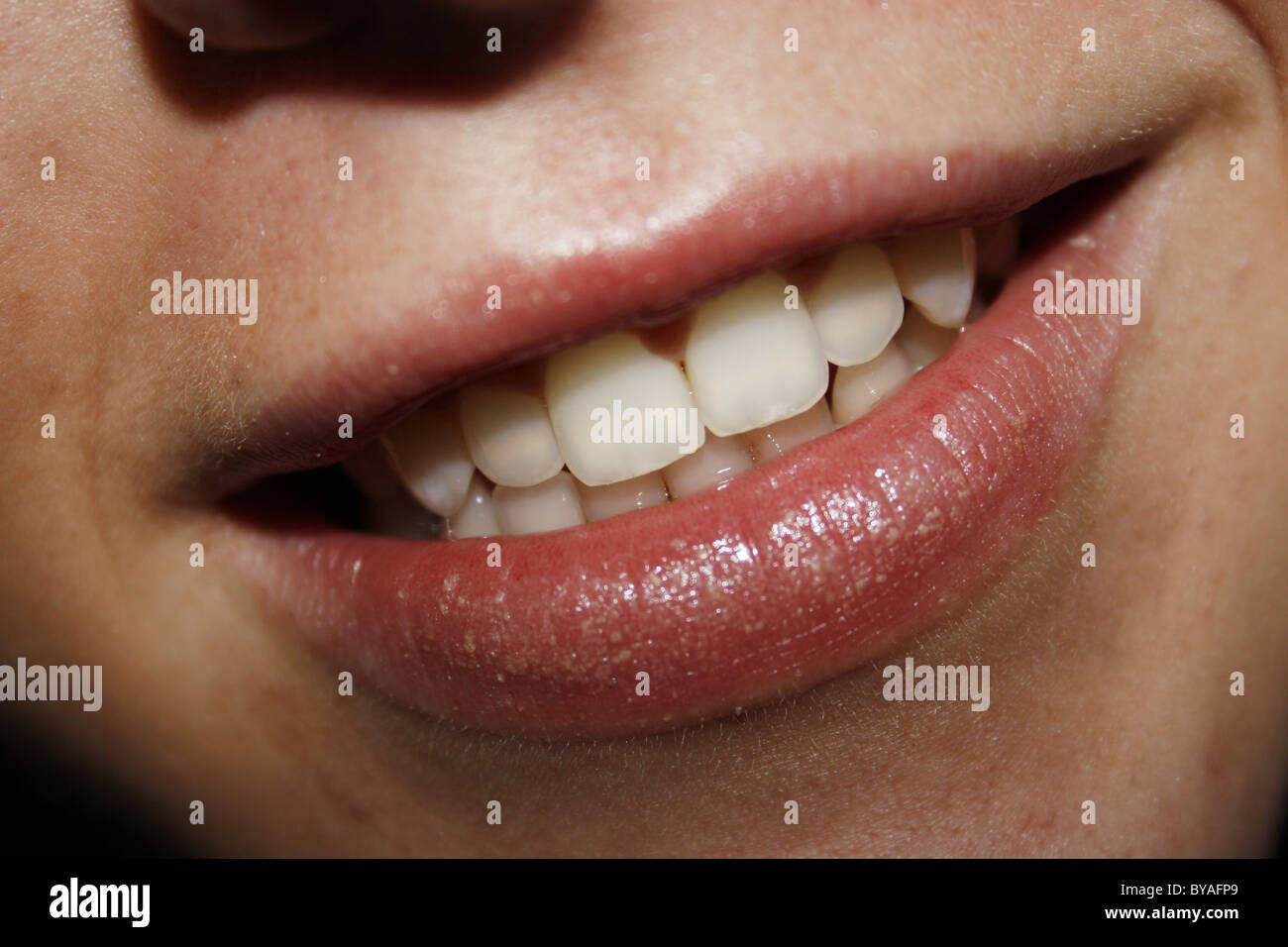 close up of teeth and lips Stock Photo