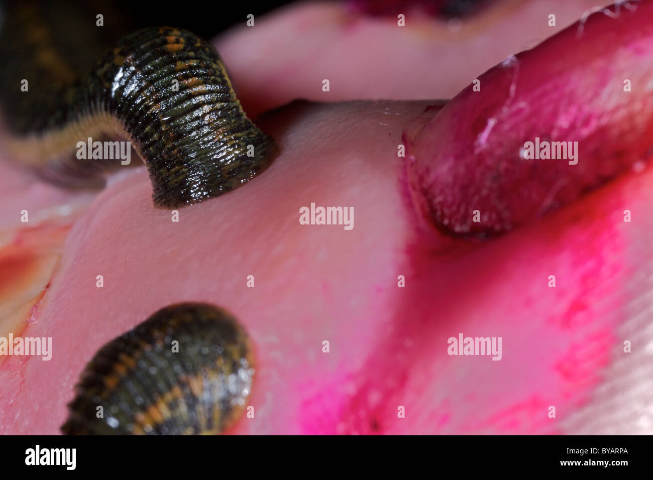 Medicinal leeches applied to the tongue