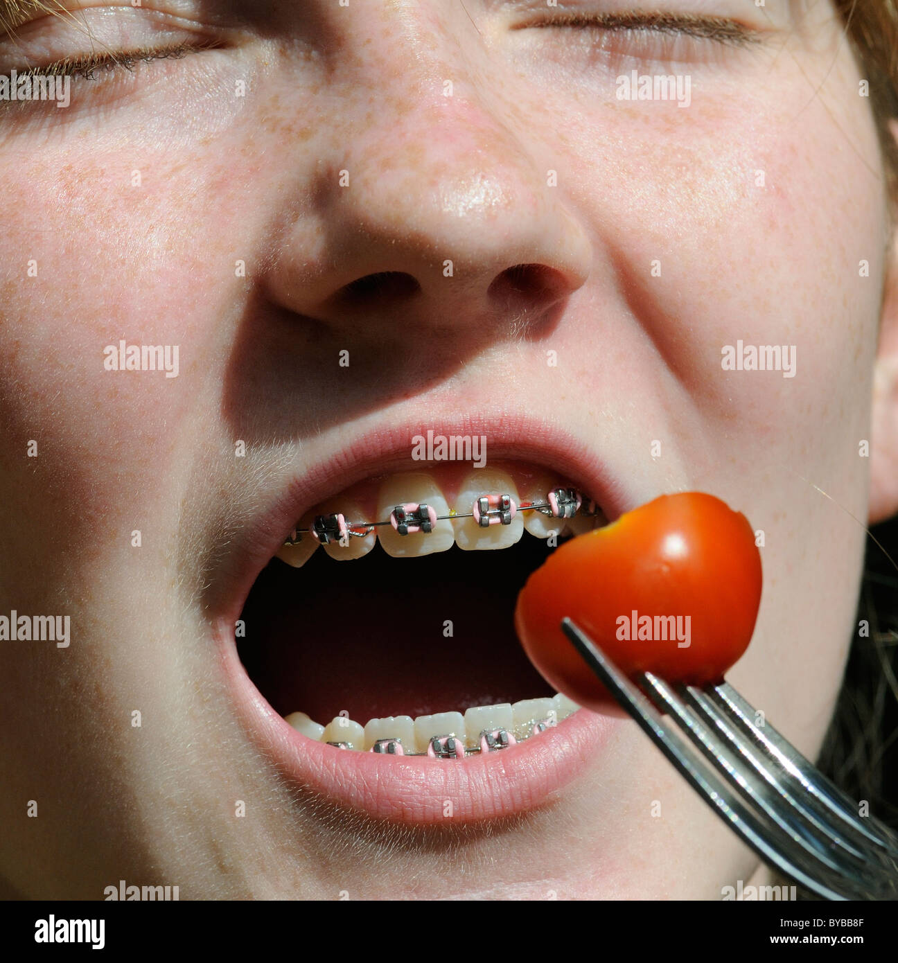 Young girl with dental brace eating a cherry tomato Stock Photo Alamy