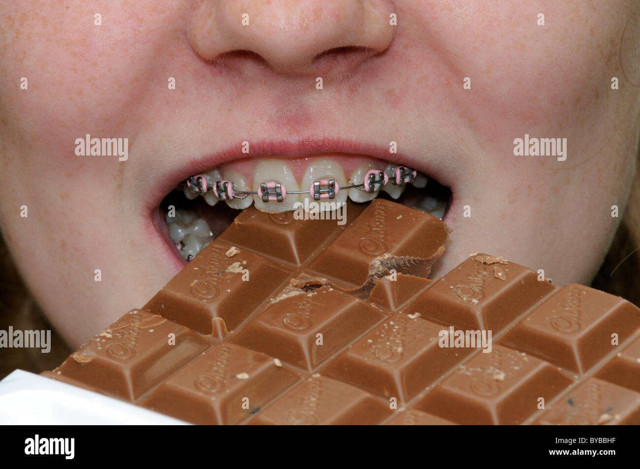 Young girl with dental brace eating a bar of milk chocolate Stock Photo