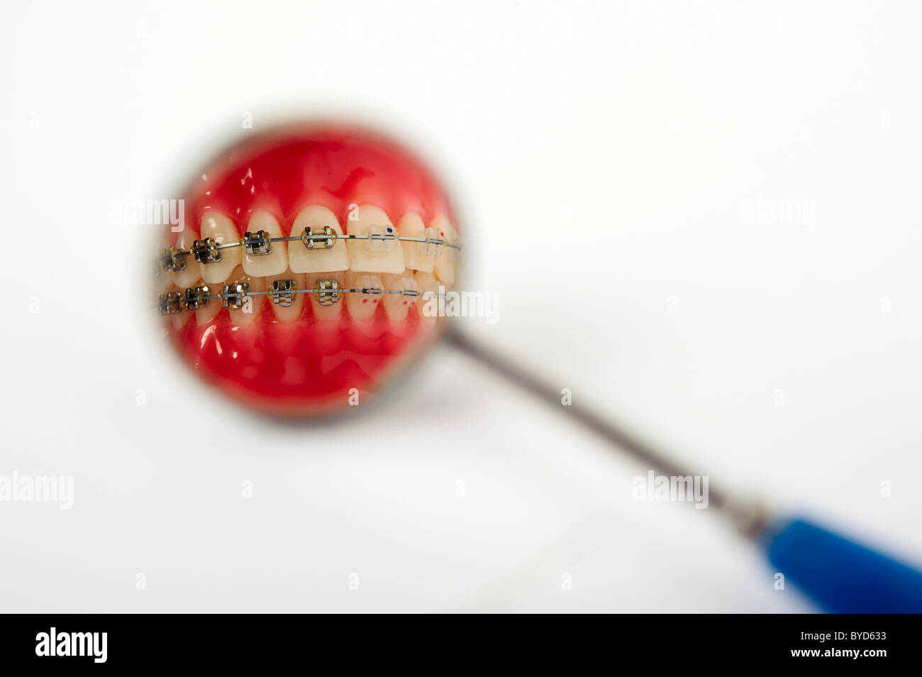 Dental hygiene, set of teeth with fixed braces partially reflected in a ...