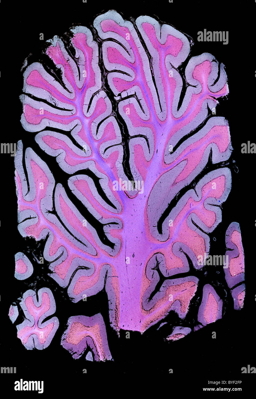 Darkfield photomicrograph human brain cerebellum section Stock Photo