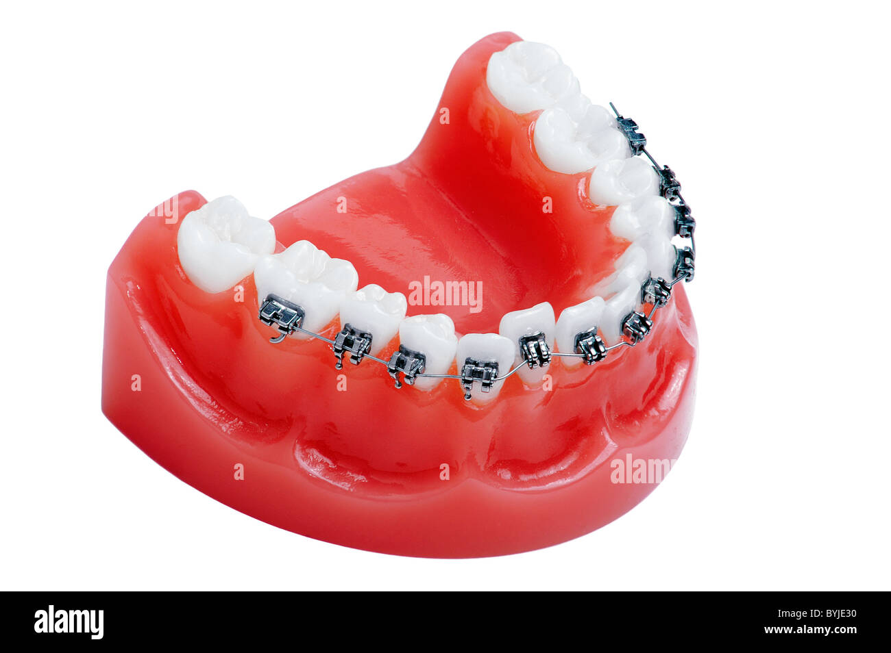 Denture with braces , lower jaw , isolated on white Stock Photo