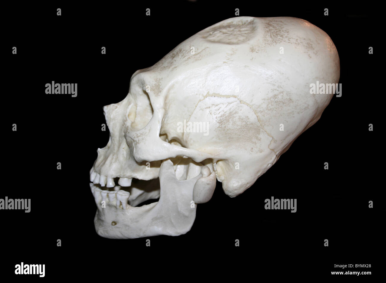 Elongated human skull hi res stock photography and images Alamy