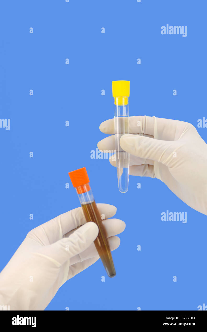 Clean and dirty water samples in test tube Stock Photo Alamy