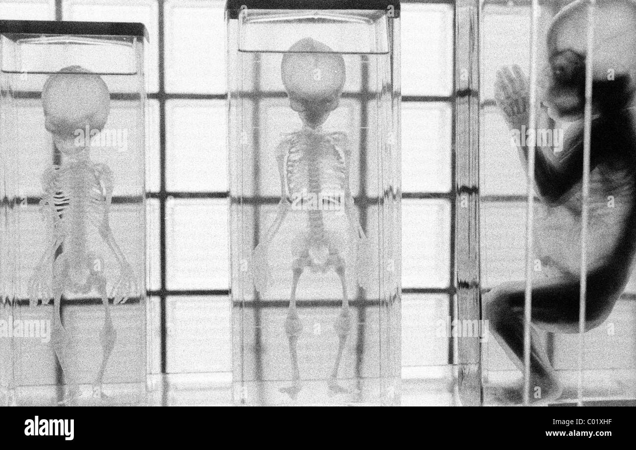 Anatomy, anatomical specimens, baby, infant Stock Photo