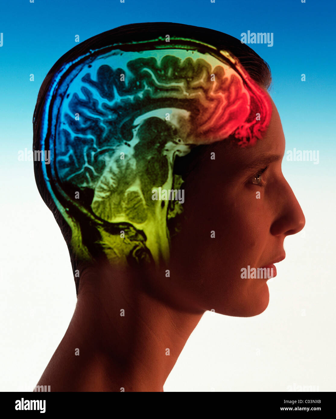 Brain scan super-imposed on head of woman Stock Photo
