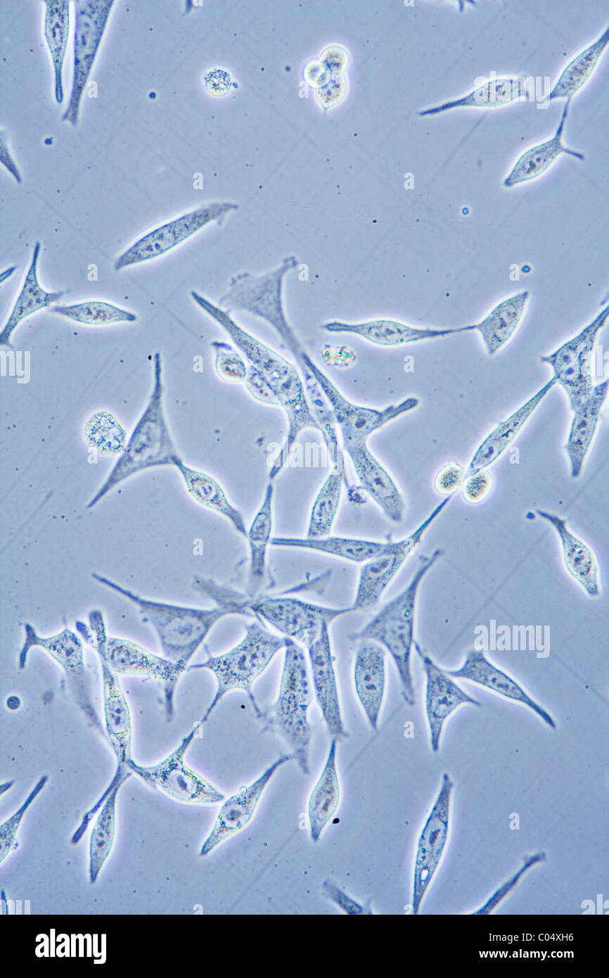 Microscope view of Prostate Cancer cells in tissue culture showing walls, nucleus and organelles. Stock Photo