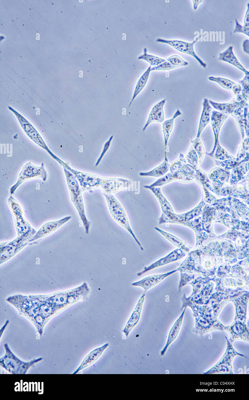 Microscope view of Prostate Cancer cells in tissue culture showing walls, nucleus and organelles. Stock Photo