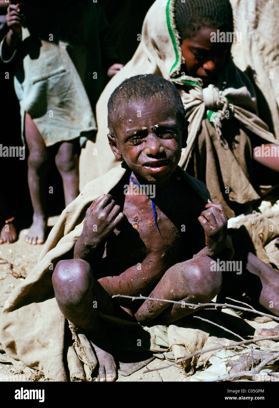 Famine victim in Darfur Sudan Africa Stock Photo