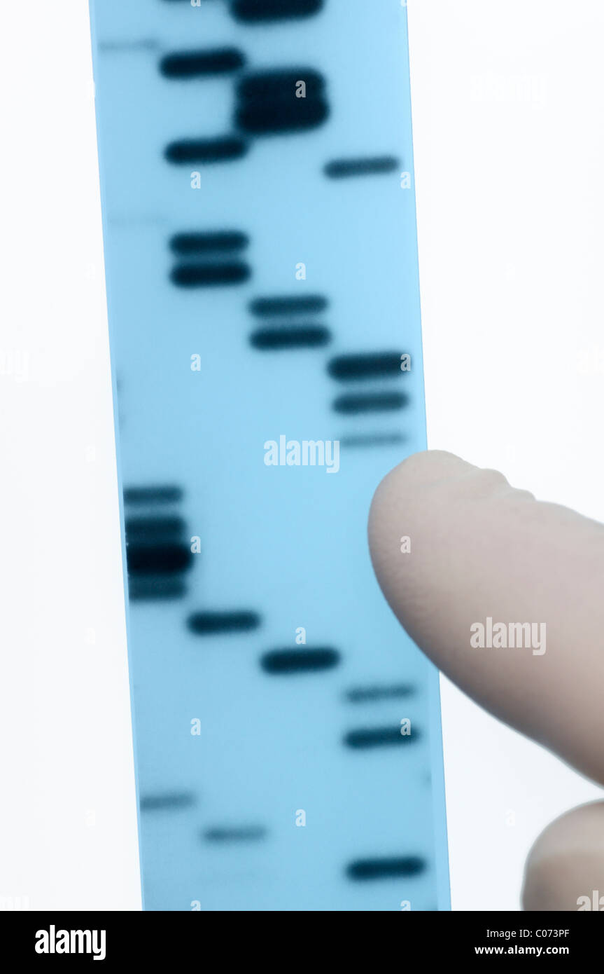 DNA sequencing. Scientist points to bands representing nucleotide bases (A,C,T,G) in an x-ray image of a gel.  Sanger method. Stock Photo