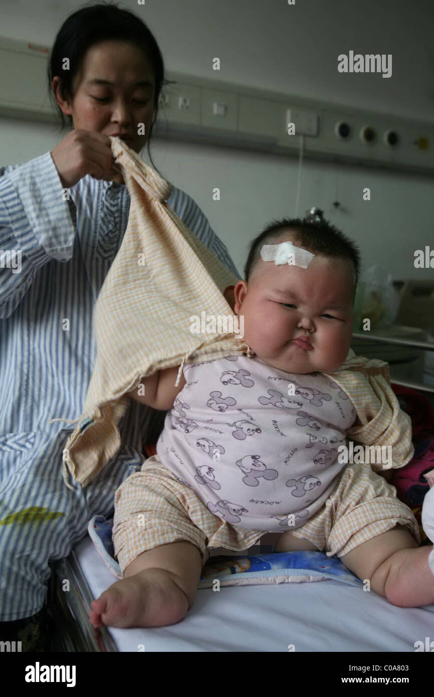 WEIGHT WORRIES FOR OBESE BABY This big baby weighs in at an