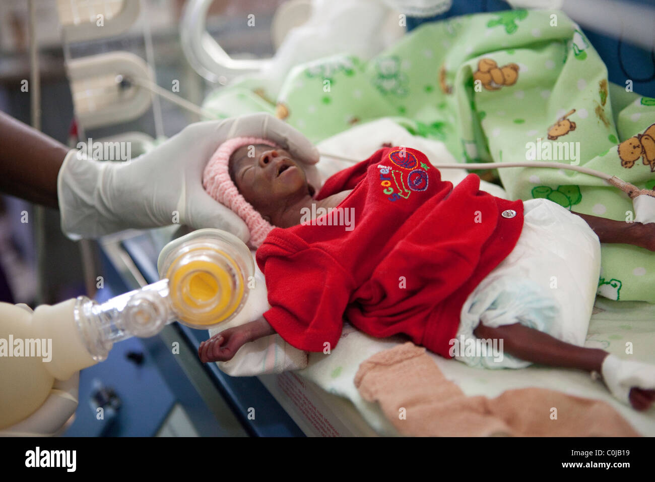 A premature baby receives care in the Special Care Baby Unit at Mulago Hospital in Kampala, Uganda. Stock Photo