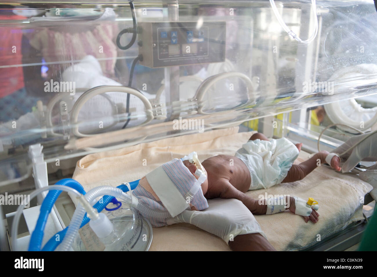 premature infant care