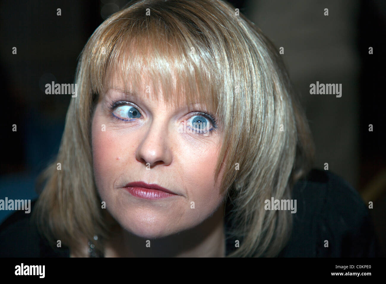 Cross eyed lady with Esotropia a lazy eye that looks in towards the nose Stock Photo