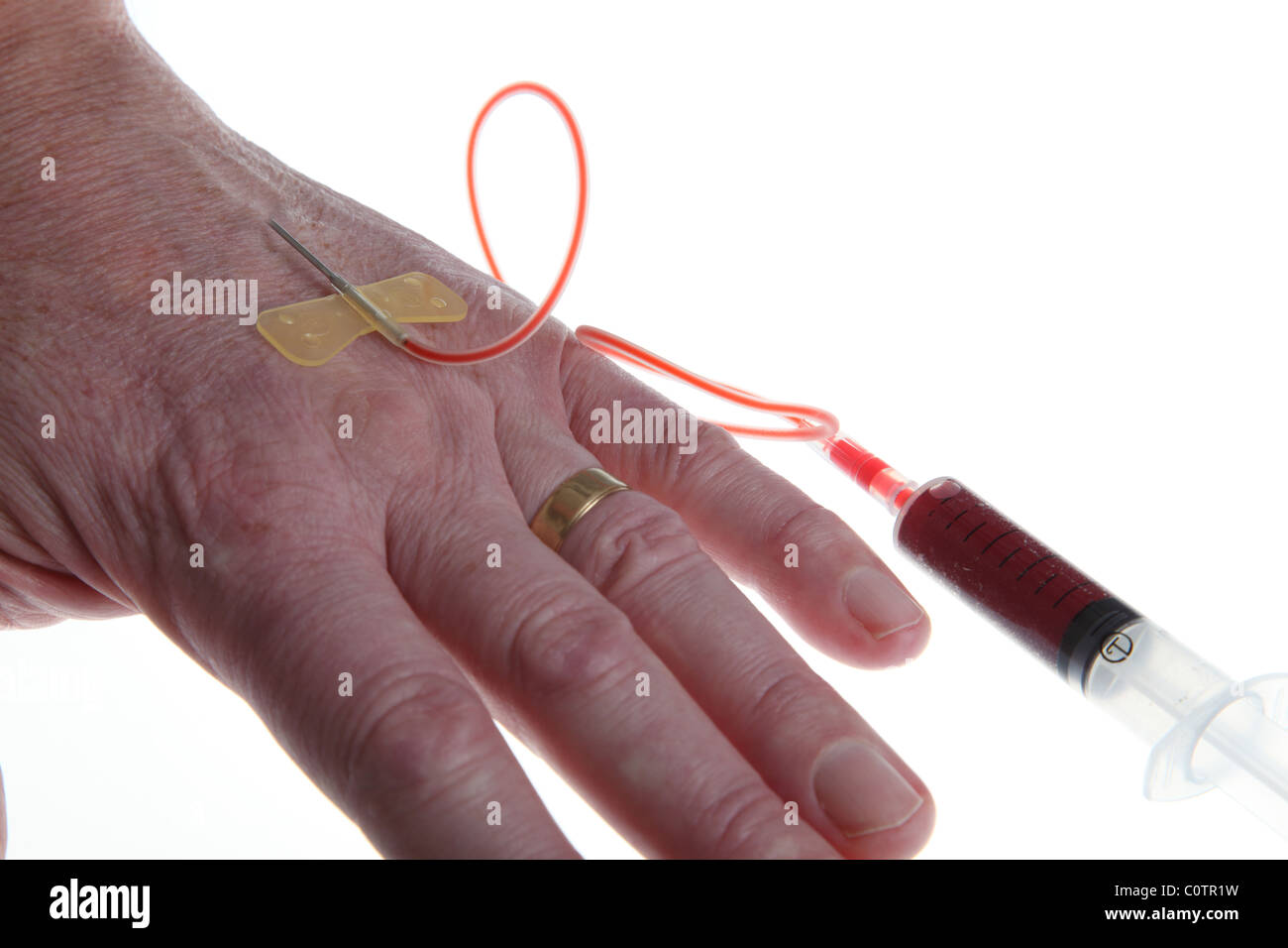 Blood sample being taken Stock Photo Alamy