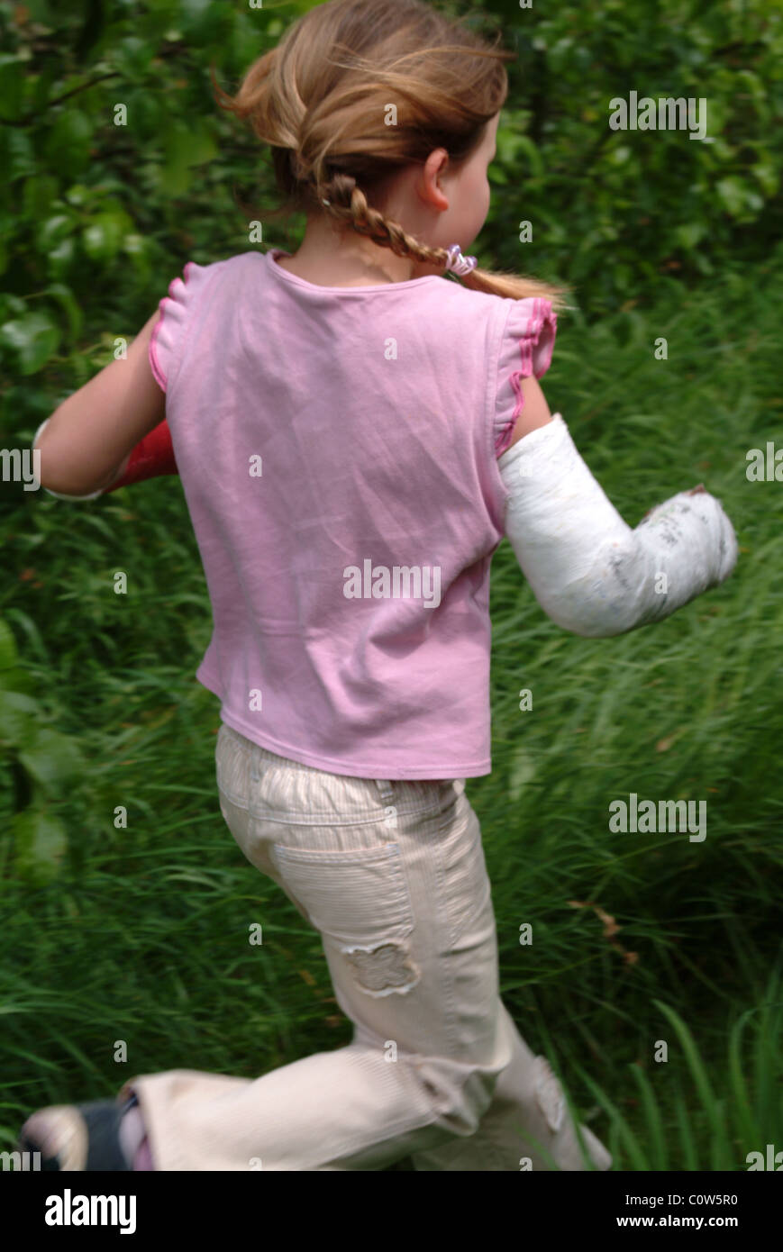 Little girl running with a broken arm Stock Photo Alamy