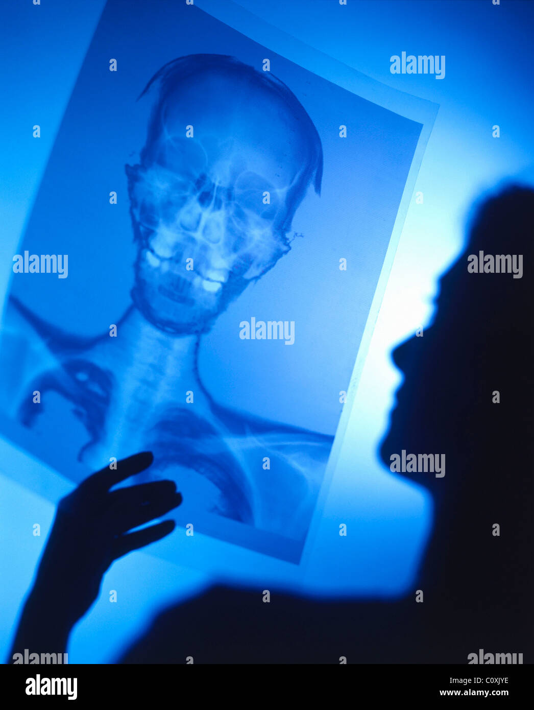 Diagnosis x ray nhs doctor hi-res stock photography and images - Alamy