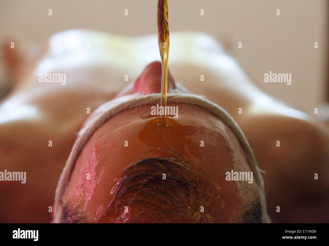 Shirodhara, oil being poured on the forehead, Ayurvedic treatment, Bethsaida Hermitage near Kovalam, , southern India, India Stock Photo