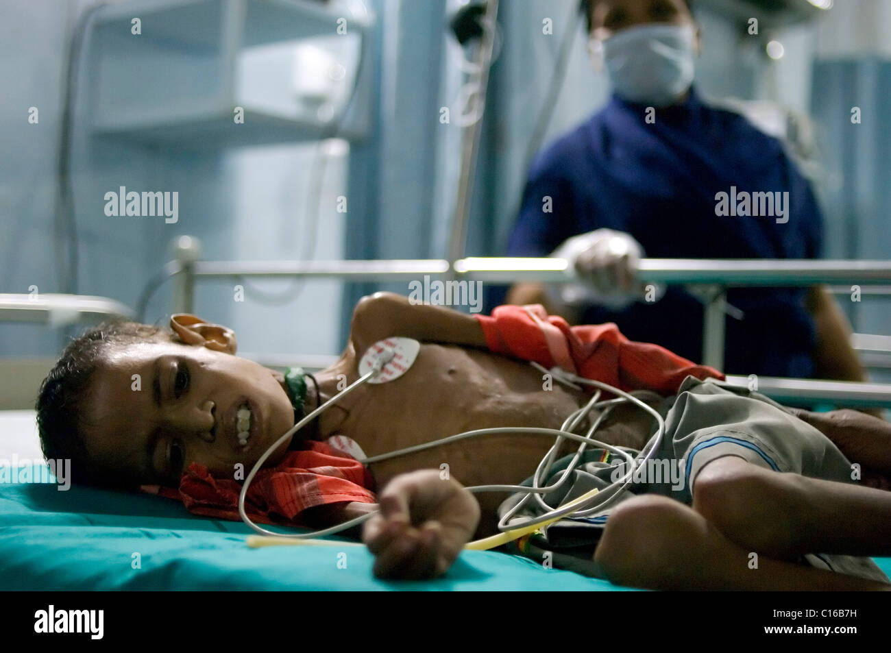 Young Rotique, 9, diagnosed with severe tuberculosis, was admitted to the intensive care unit of the Shree Jain Hospital. It is Stock Photo