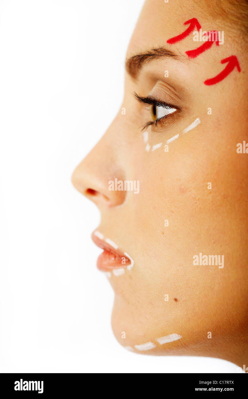 Young woman with lines on her face for cosmetic surgery Stock Photo