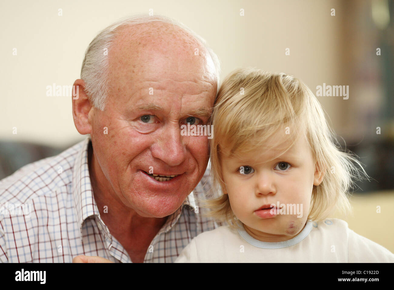 Grandpa, small girl with a hemangioma Stock Photo